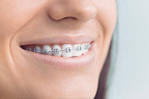 Best Teeth Whitening  in Vivian, LA